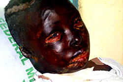 Woman bathes rapist with acid
