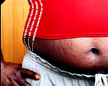Obesity Nigeria’s growing health concern – report