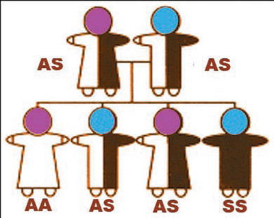 sickle cell