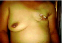 Woman docked for allegedly cutting husband’s lover’s breast with razor