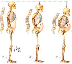 Don’t patronise quack bone setters, Orthopedic doctors warn