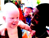 Witchcraft threatens albinos with extinction: UN expert