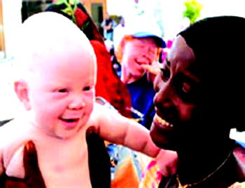 Stop killing albino babies, AFRIBABY pleads