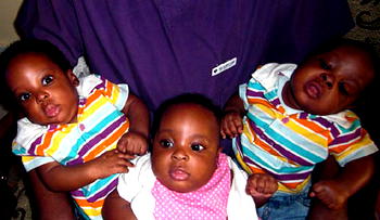 Multiple births: Many babies for the price of one