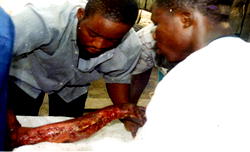 There’s no bone injury I can’t cure – Frank Biere