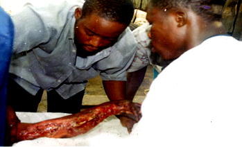 There’s no bone injury I can’t cure – Frank Biere