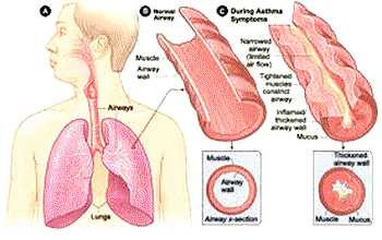 Cleaning jobs linked to asthma risk