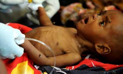 MALNUTRITION: Nigeria may lose 876,000 children in 2023 — Stakeholders
