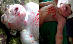 Woman delivers weird baby  in Ekiti