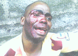Day ‘disabled’ bus operators went gaga in Lagos