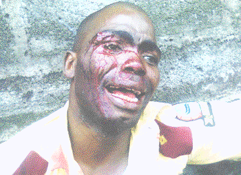 Day ‘disabled’ bus operators went gaga in Lagos