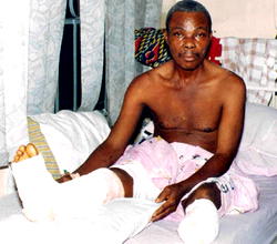 Anukwu, amputated Luxury Bus driver gets help from NSITF