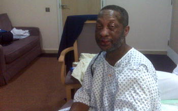 Only redress can assuage my pains – victim of drug reaction