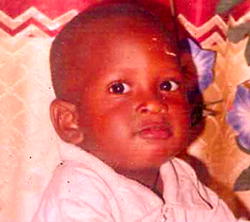 ‘Pls help! Keloids is destroying my son’