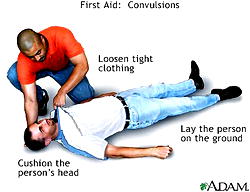 Convulsion can be controlled and it is not contagious