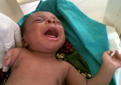 WICKED: Man chopped off baby brother’s hand