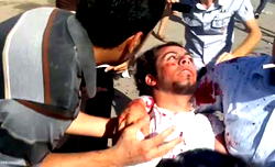 America, Syria and the rest of us