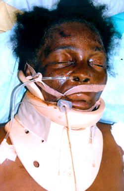 Unknown patient at LUTH