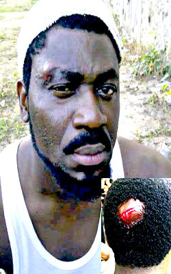 How Nollywood actor was attacked by thugs – Ayo Badmus