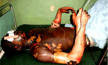 Many mysteries of the Kaduna blast