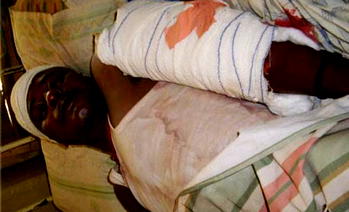 Two hospitalized as motorcyclists, FRSC  clash at Nsukka