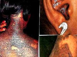 Who stole my ‘Bleashing’?