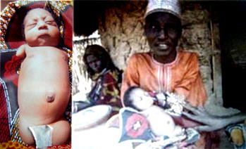 Father of girl born without hands and legs says she is a gift from God
