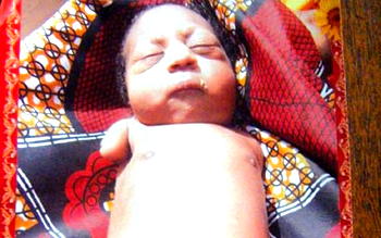 Father of girl born without hands and legs says she is a gift from God