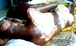 Victim of electric shock cries out for help