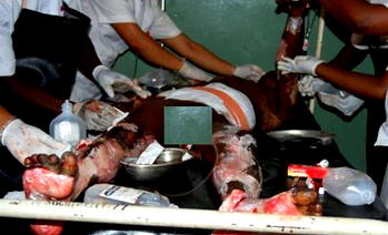 Victims of Thursday Kaduna twin bomb blasts speak