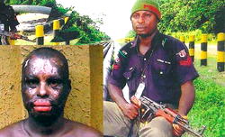 How Police Corporal was burnt by oil pipeline fire and abandoned by his employers