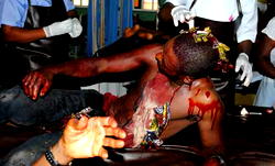 Terror attack at wedding leaves many injured