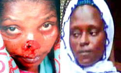 S-H-O-C-K: Wife chops off woman’s nose for alleged affair with hubby