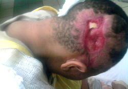 How trigger-happy policeman renders woman incapacitated