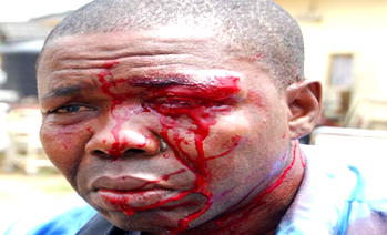 Journalist’s battering:  Acid test for Office of Public Defender