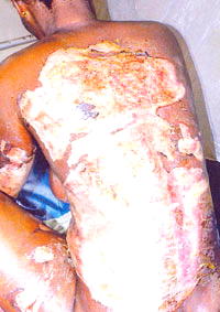 Jealous husband sets wife on fire for accepting wine from another man at party