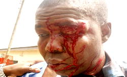 Dana crash: Photojournalist recounts ordeal with  undertakers