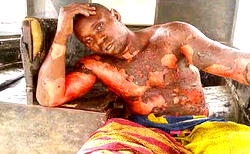 Inferno claims two, injures four  at Lekki