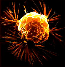 Supplements to avoid to prevent prostate cancer