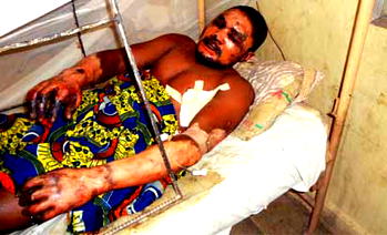 Kano Blast: 31 victims receiving treatment at Murtala Muhammed Hospital