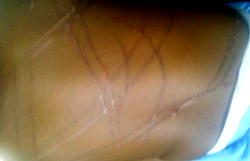 Shocking: Father lacerates back of 14-month-old baby