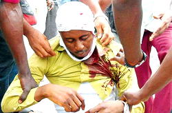 Brush with a moving train