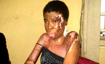 ALLEGED DEADLY ATTACK BY FIANCE: ‘My case was closed unjustly by the police’