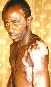 How man was bathed with acid by ‘professional colleague’