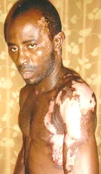 How man was bathed with acid by ‘professional colleague’
