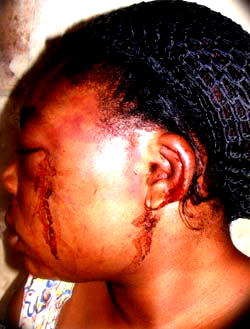 Woman battered for cautioning lover against smoking Indian hemp