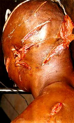 N-a-r-r-o-w e-s-c-a-p-e! Encounter with Fulani herdsmen in Delta