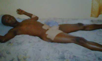 PATHETIC! Victim of police stray bullet rendered impotent