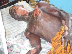 B-i-z-z-a-r-e: How man sets youths ablaze during argument