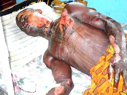Man sets himself ablaze in front of ex-Prime Minister’s house